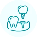 implant implant