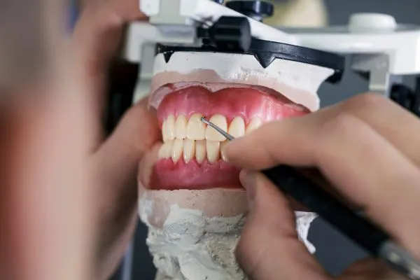 mandibular Joint