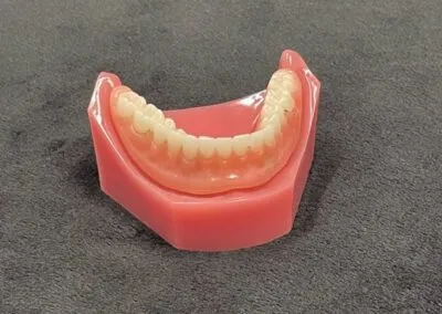 Loose Denture 3
