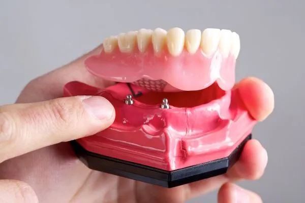 Loose Denture Solution