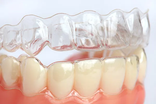 invisalign20178